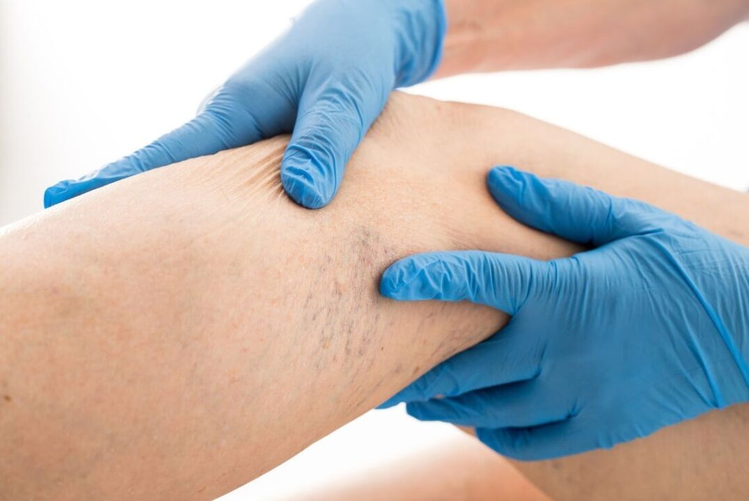 Clinical kartin disease disease