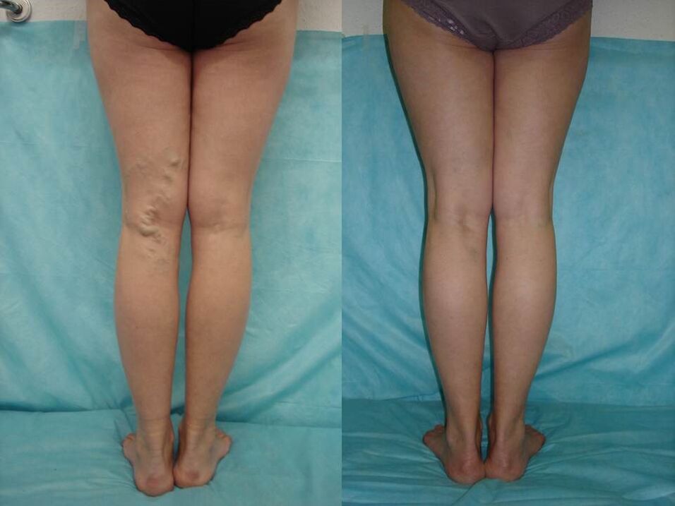 before and after treatment with Vetonus gel
